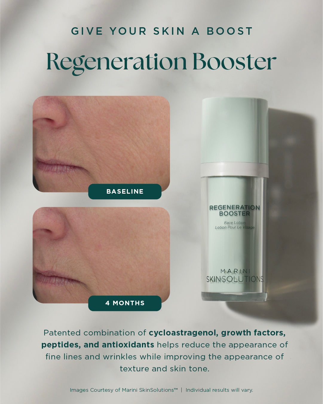 Regeneration Booster